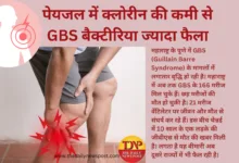 GBS: पुणे में 5 मौतों के बाद चेन्नई में जीबीएस से एक मौत